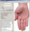 Su-Jok - TCM - Acupuncture open point 2.0 Software Download